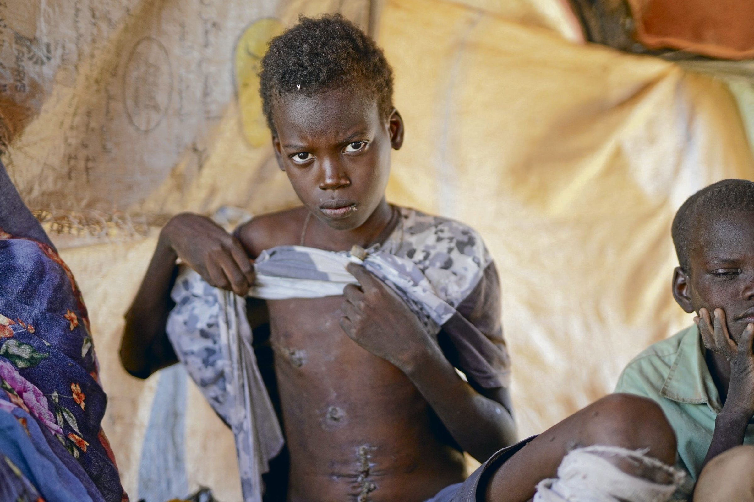 Humanit-re-Krise-Krieg-im-Sudan-Kindersoldaten-und-chemische-Waffen