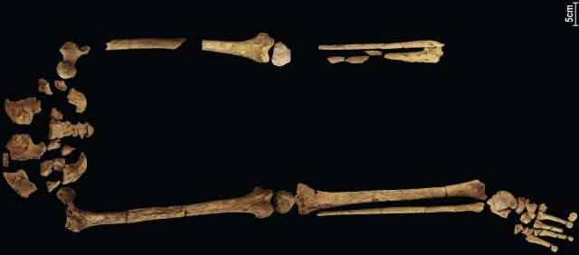 oben die Knochen des vor 31 000 Jahren amputierten Beins