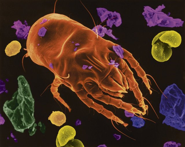 Eine Hausstaubmilbe unter dem Raster-Elektronen-Mikroskop. Anbei Kotpellets, Pollen und menschliche Hautschuppen