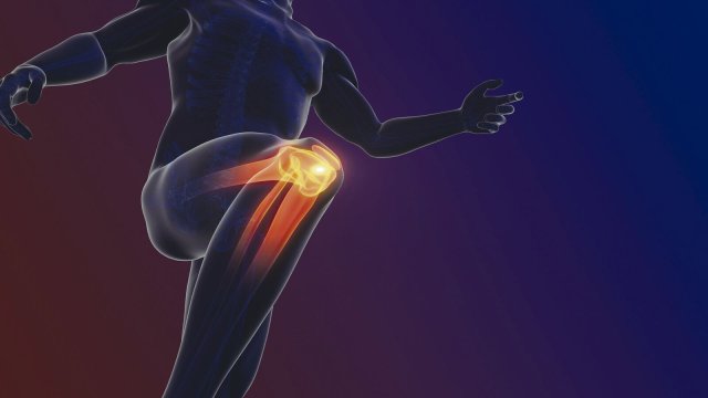 Bei Dauerschmerz im Kniegelenk kann am Ende ein Gelenkersatz sinnvoll sein.