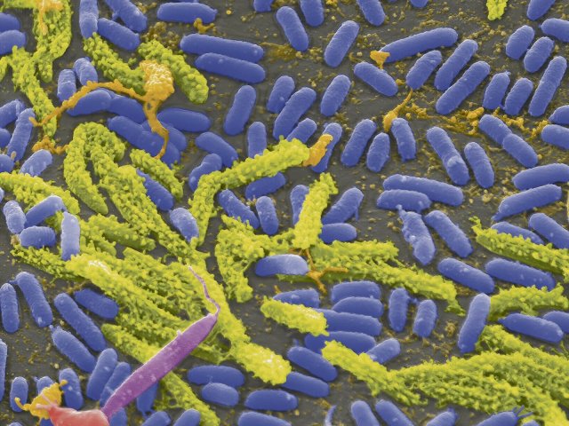 Der Erreger der Cholera ist das bekannteste Bakterium der Gattung Vibrio.