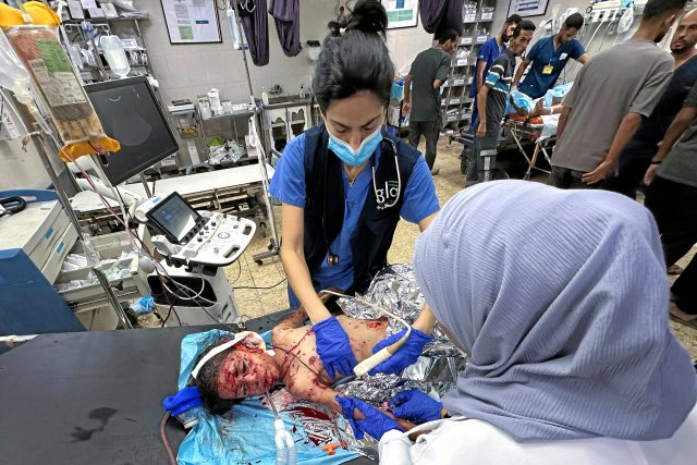 Ein verletztes Kind nach einem israelischen Angriff auf das Zeltlager für Vertriebene in Mawasi im Nasser-Krankenhaus (20. August 2025)