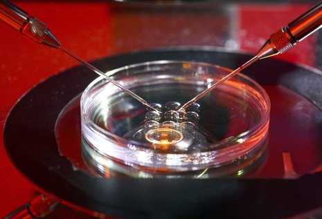 Unterm Mikroskop werden Spermien in Eizellen injiziert.
